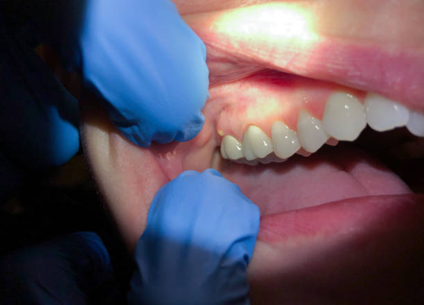 Best Urgent Care for Lost Fillings or Crowns in Sturgis, KY